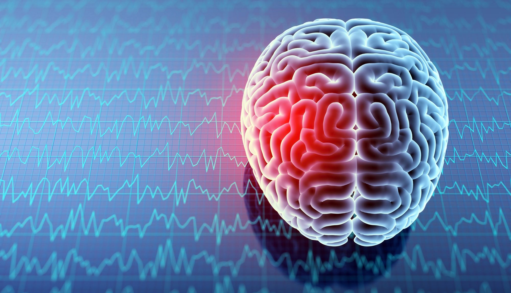 Concussions suck: My story