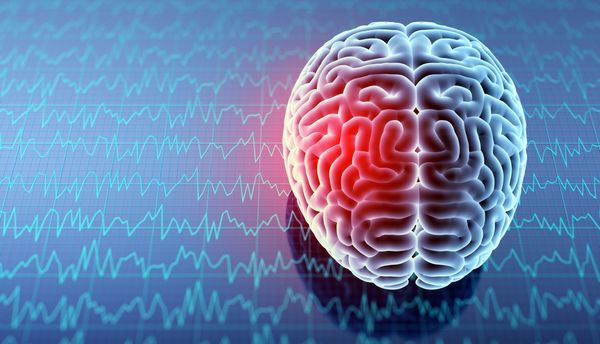 Concussions suck: My story